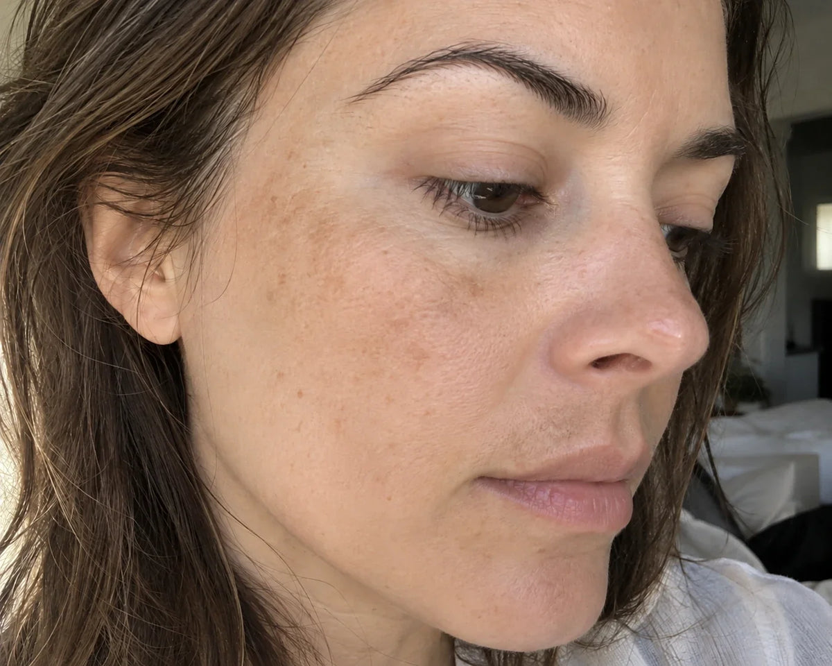Melasma Fade Cream: 7% Arbutin + 4% Tranexamic Acid